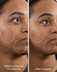 Universal Pro-Retinol